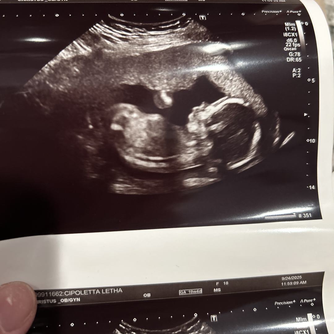 Photo shared by Letha for their Babylist baby registry.