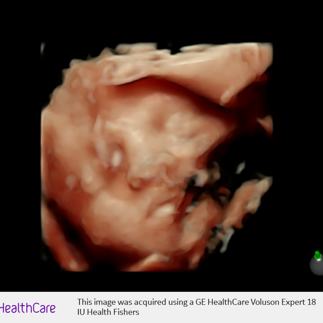 Photo shared by Jake & Stephanie for their Babylist baby registry.