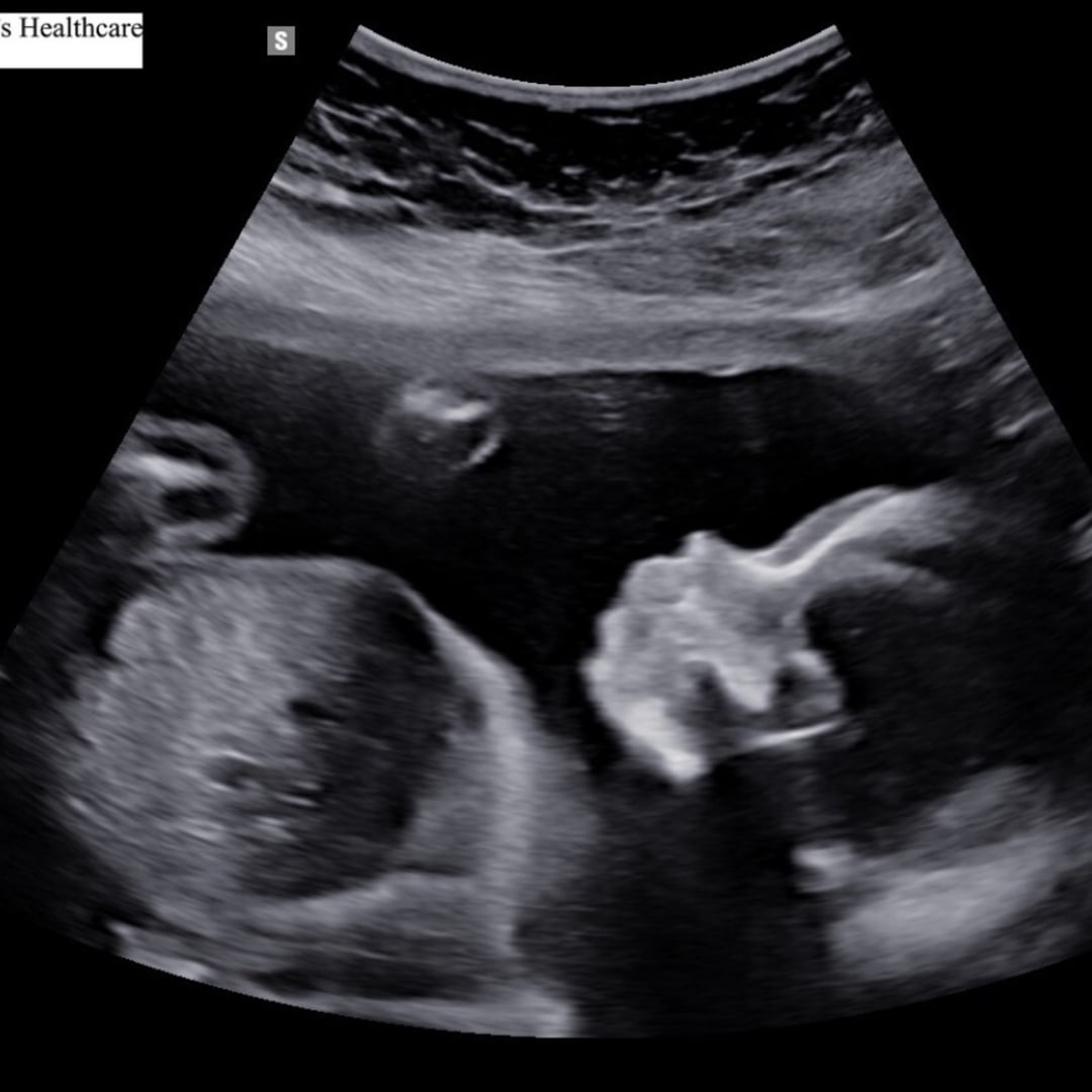 Photo shared by Bethany for their Babylist baby registry.