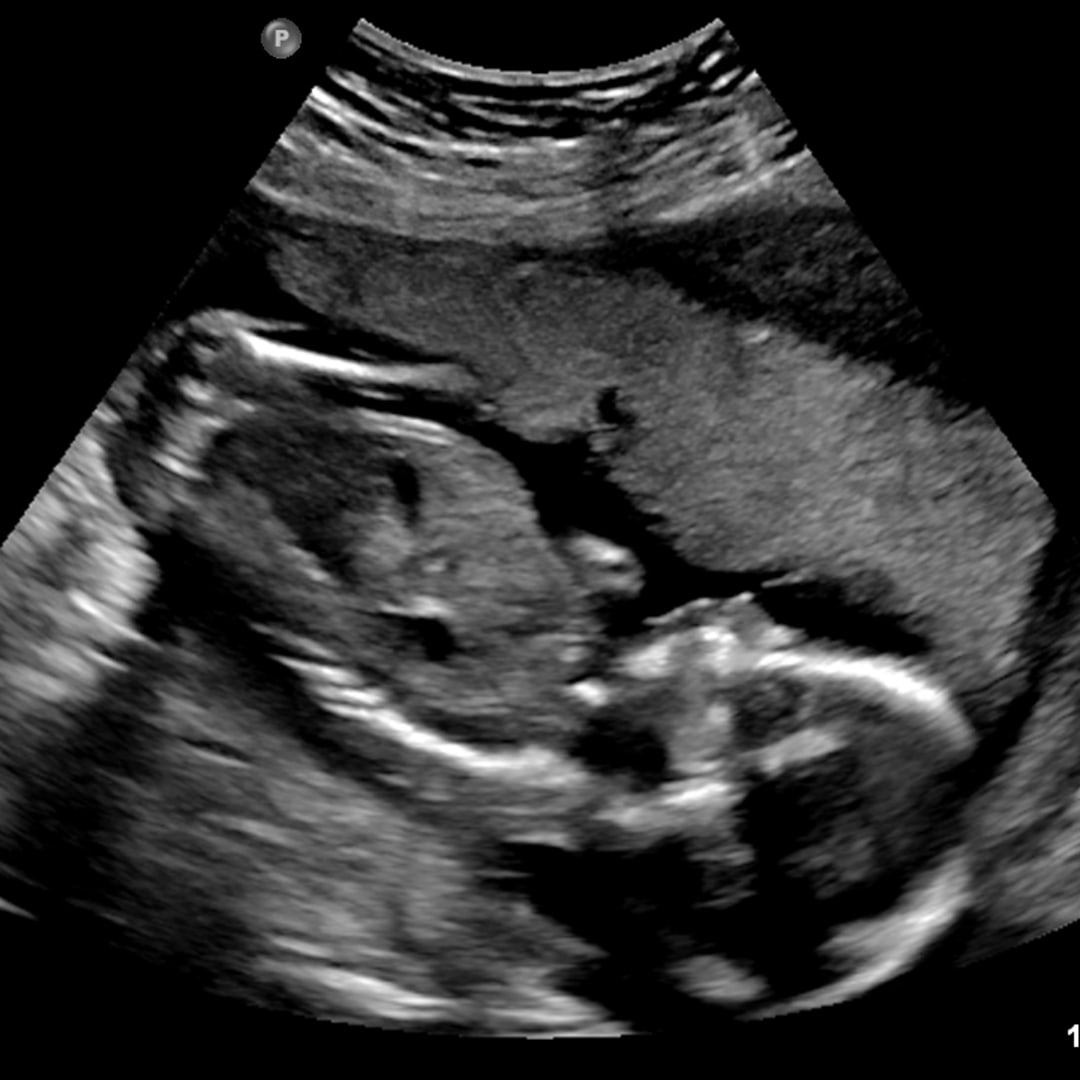 Photo shared by Alicia for their Babylist baby registry.
