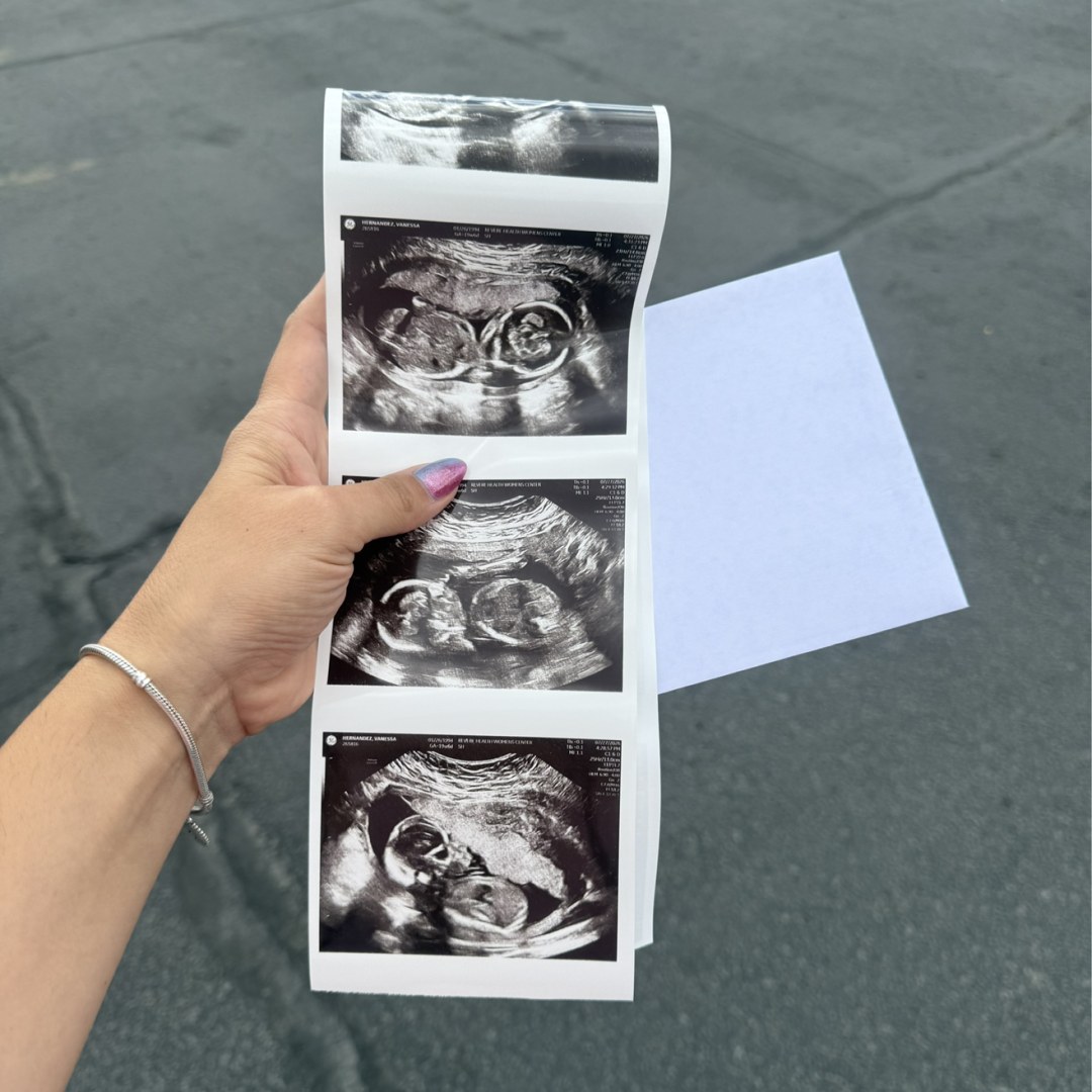 Photo shared by Vanessa for their Babylist baby registry.