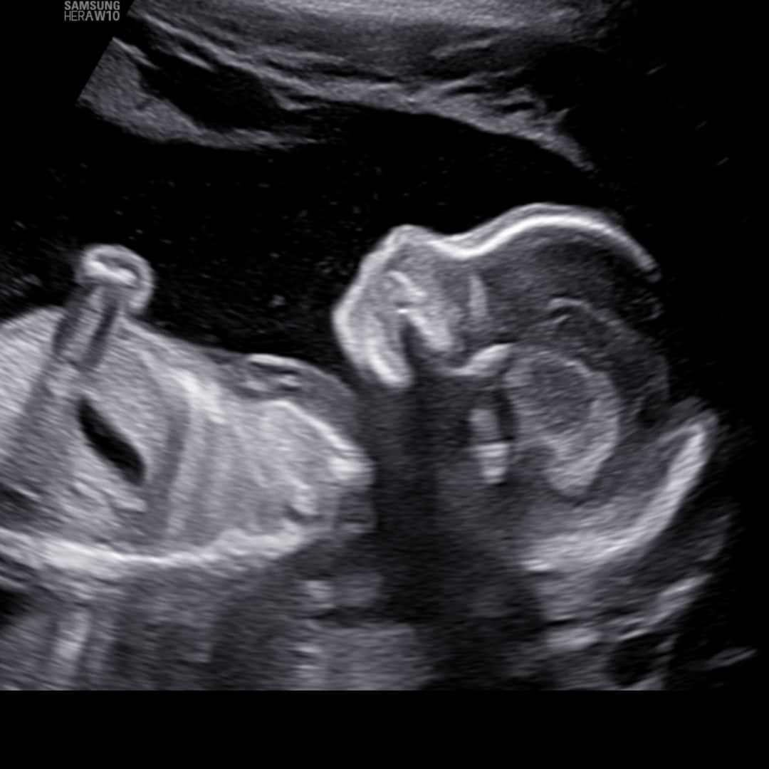 Photo shared by Karina for their Babylist baby registry.