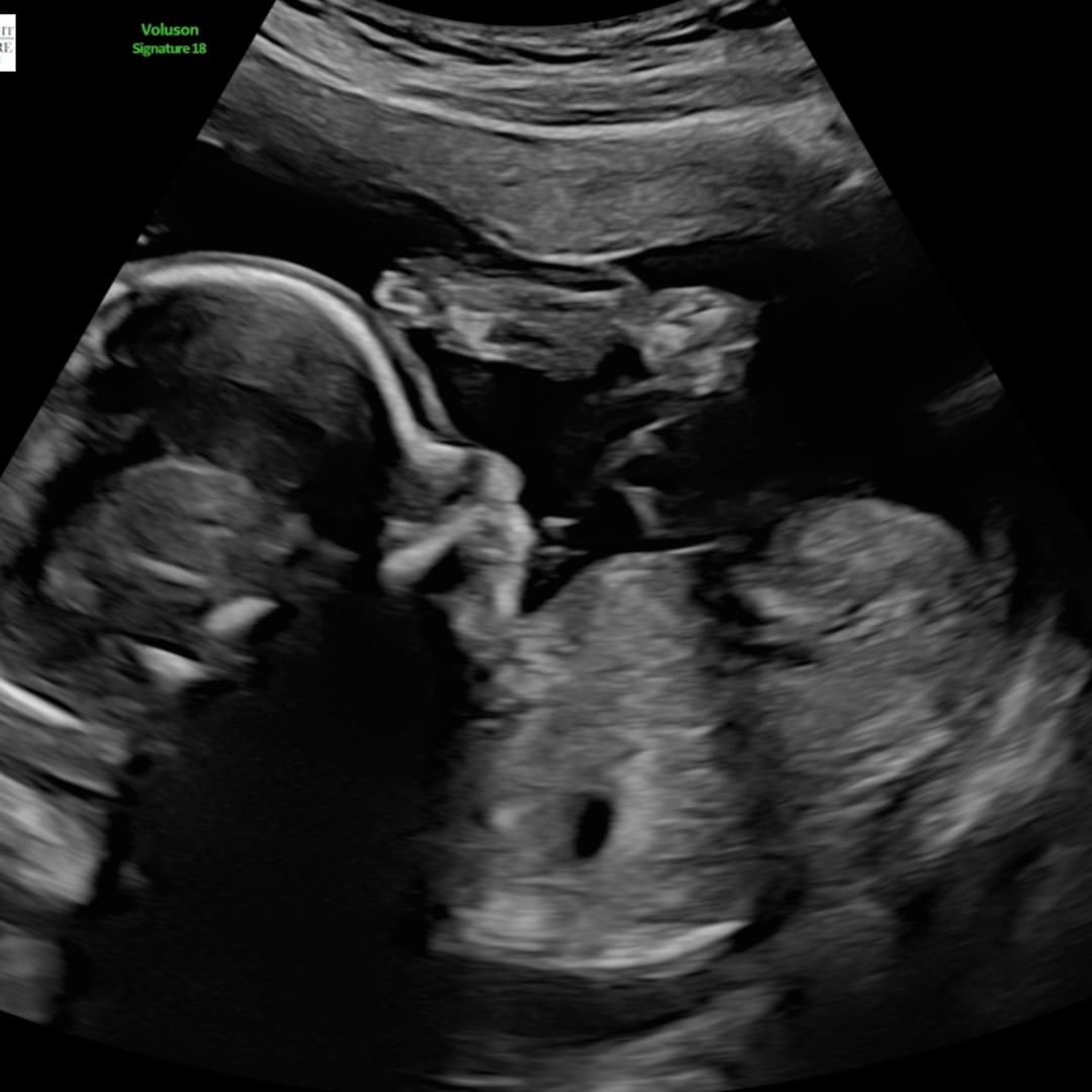 Photo shared by Hannah for their Babylist baby registry.