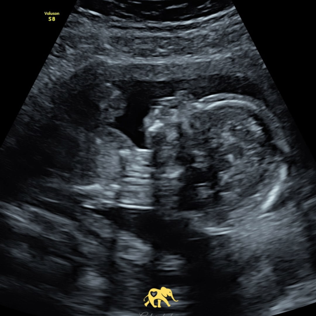 Photo shared by Ally for their Babylist baby registry.