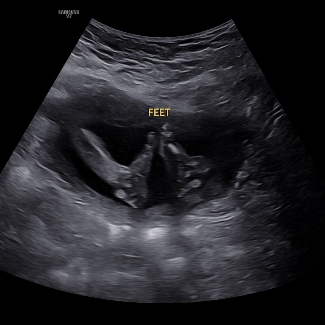 Photo shared by Lily for their Babylist baby registry.