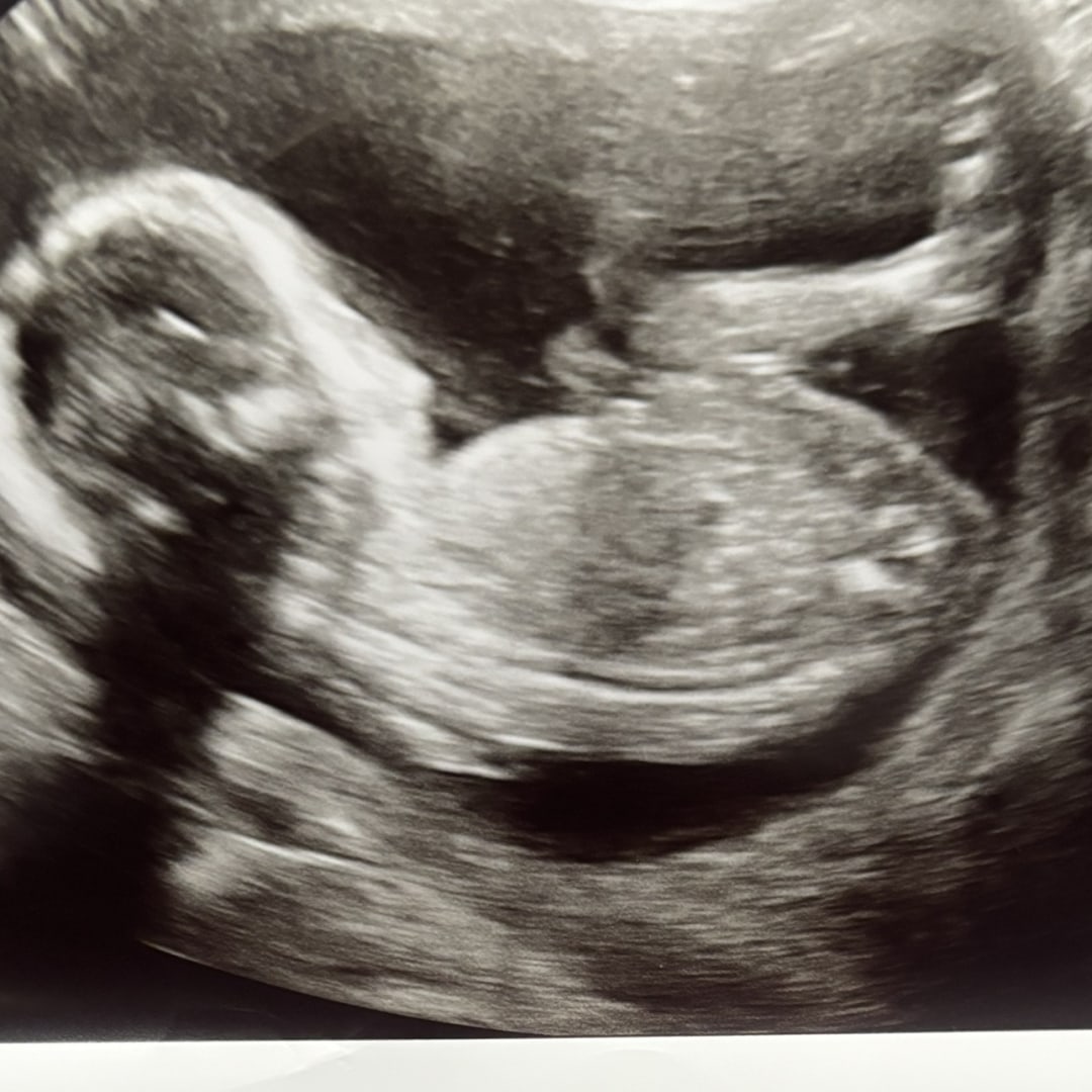 Photo shared by Deisy for their Babylist baby registry.