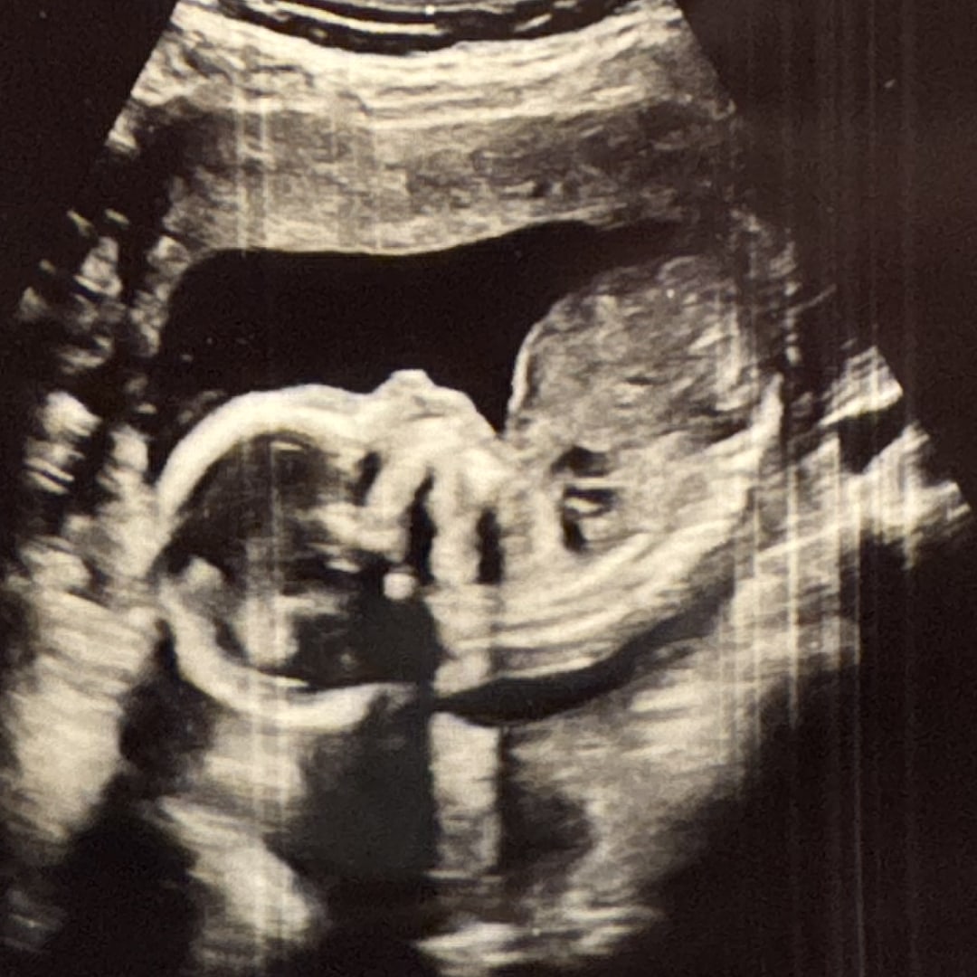 Photo shared by Emily for their Babylist baby registry.