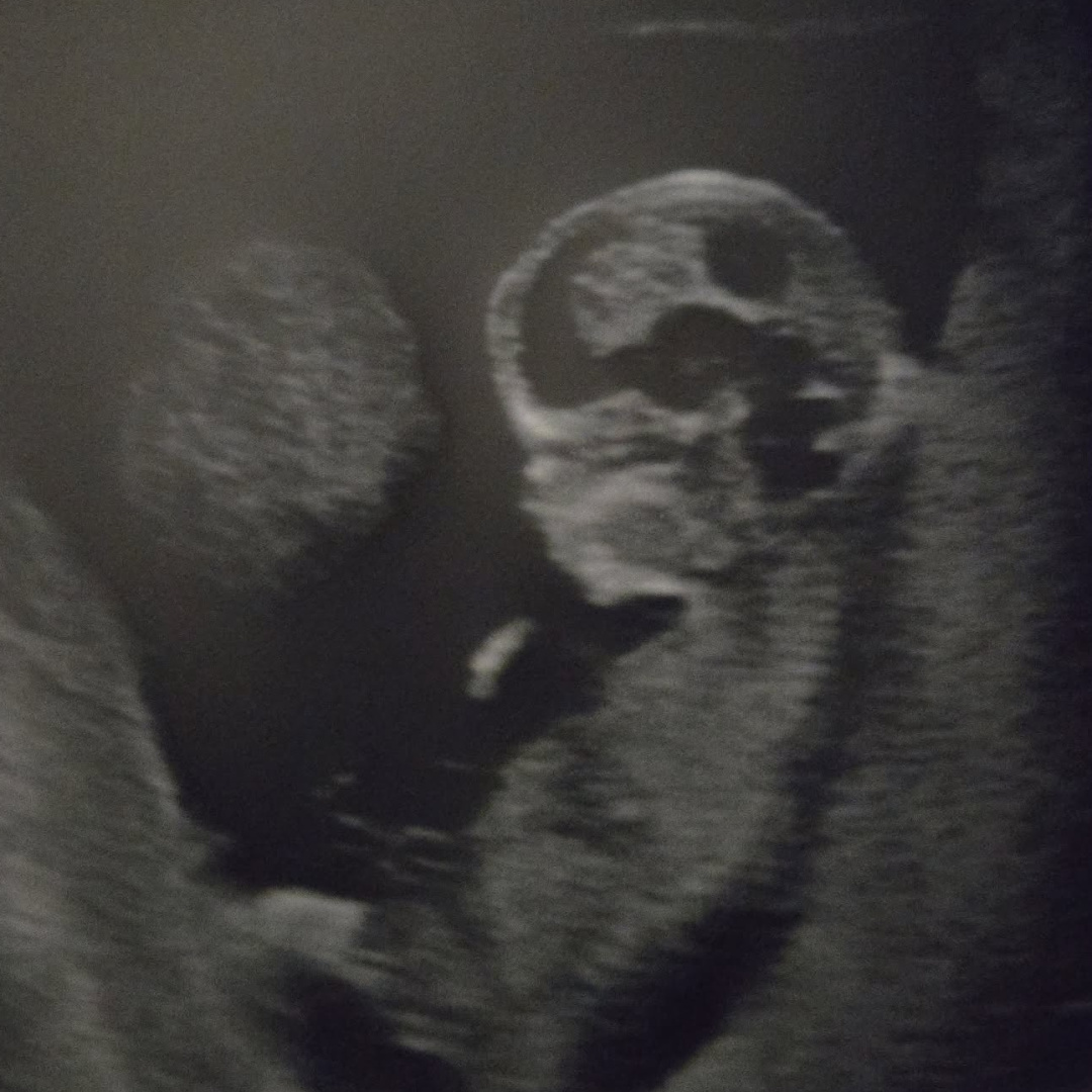 Photo shared by Gianna for their Babylist baby registry.