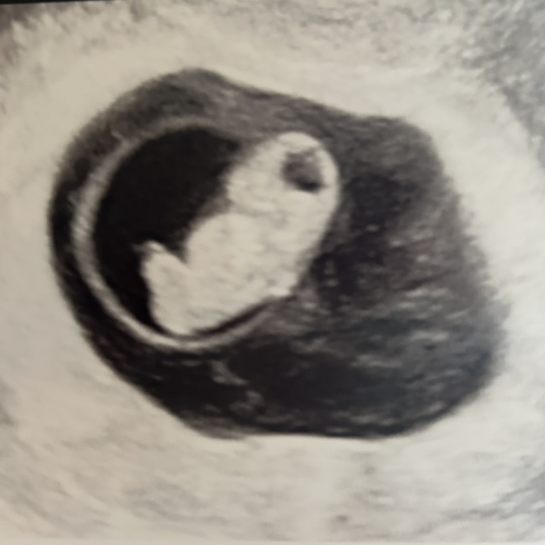 Photo shared by Brianna for their Babylist baby registry.