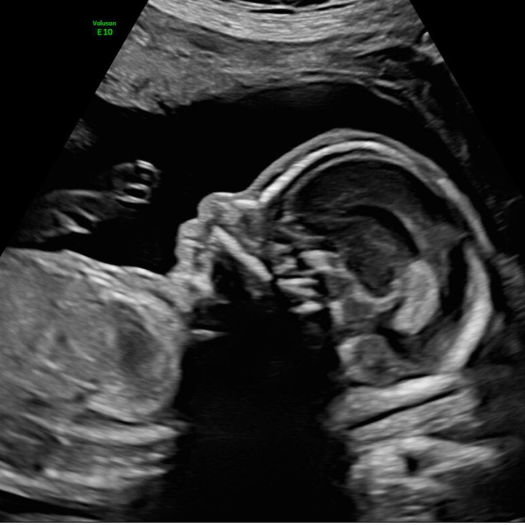 Photo shared by Alicia for their Babylist baby registry.