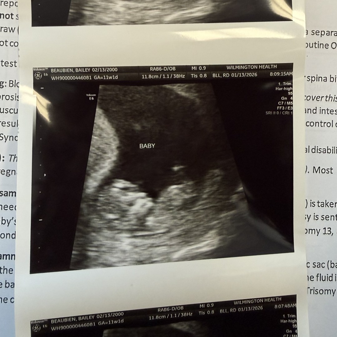 Photo shared by Bailey for their Babylist baby registry.