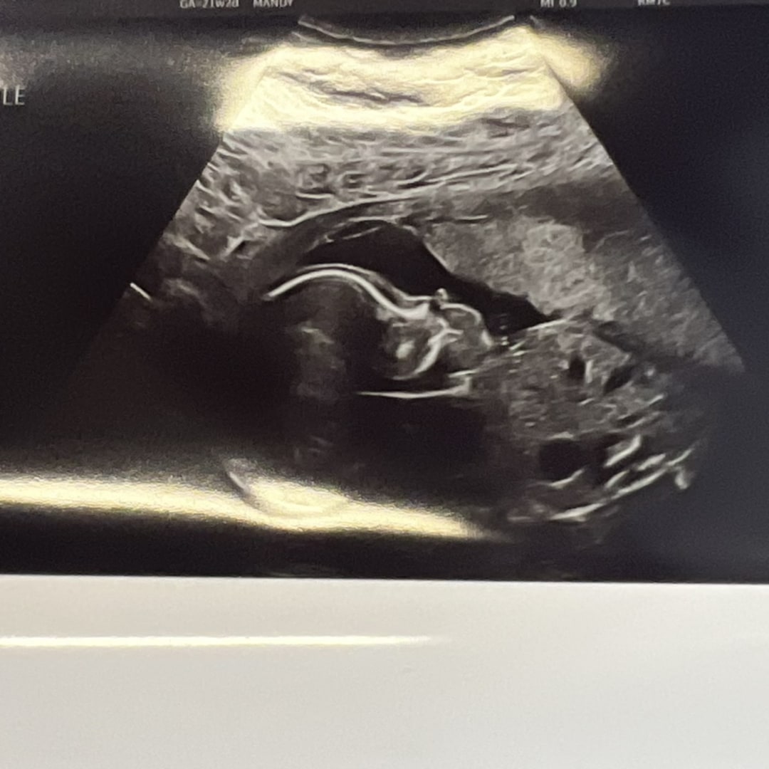 Photo shared by Elisabetta & for their Babylist baby registry.