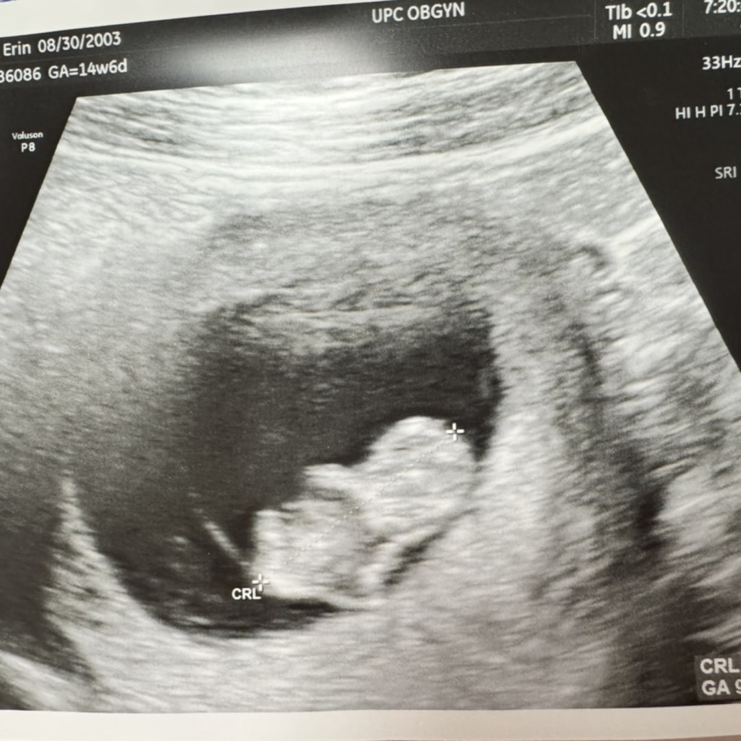 Photo shared by Erin for their Babylist baby registry.