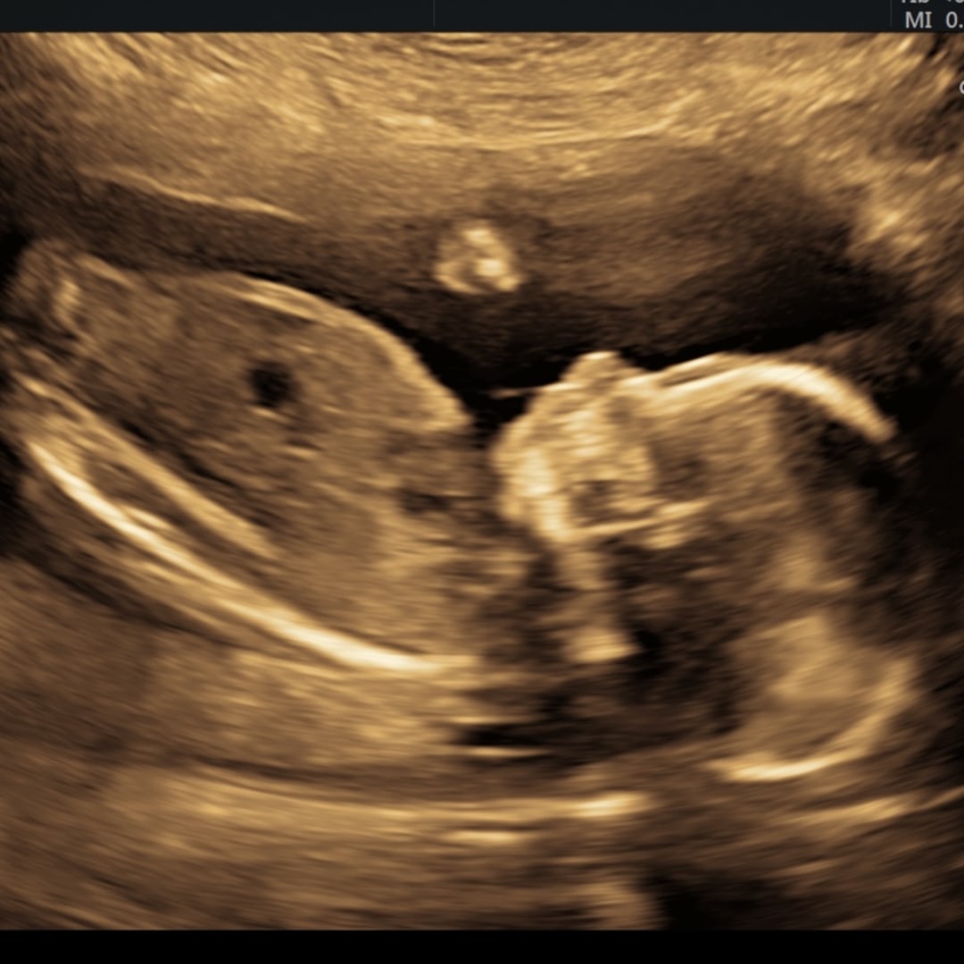 Photo shared by Chelsea for their Babylist baby registry.