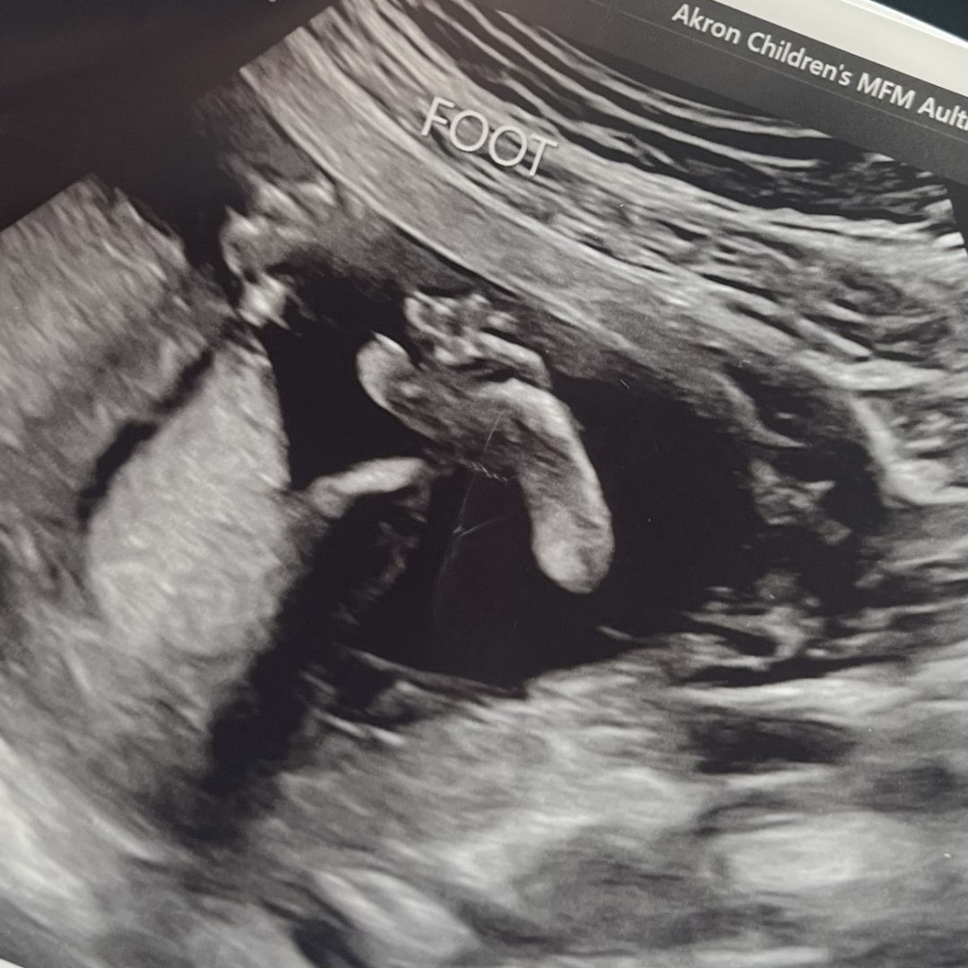 Photo shared by Makayla for their Babylist baby registry.