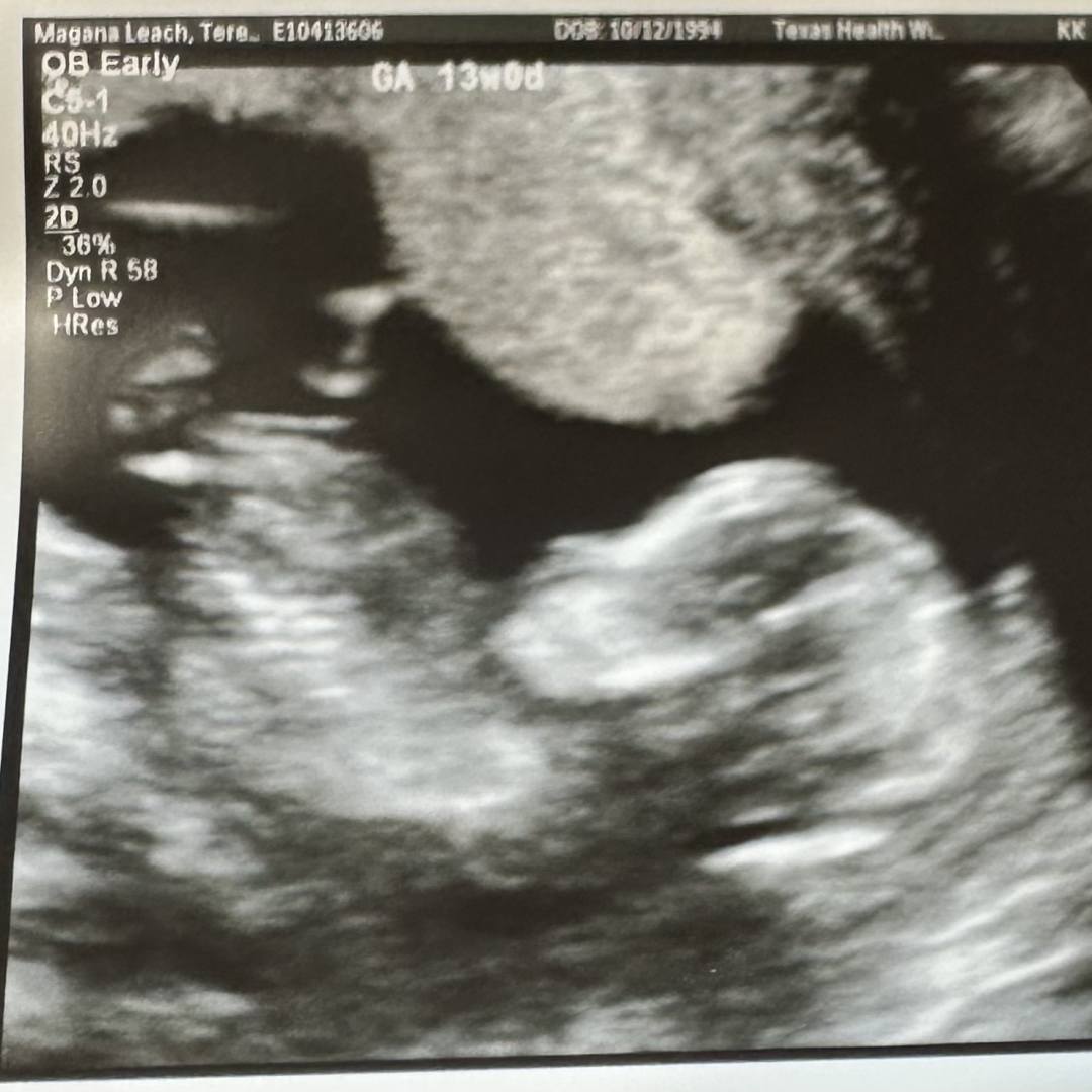 Photo shared by Teresa for their Babylist baby registry.