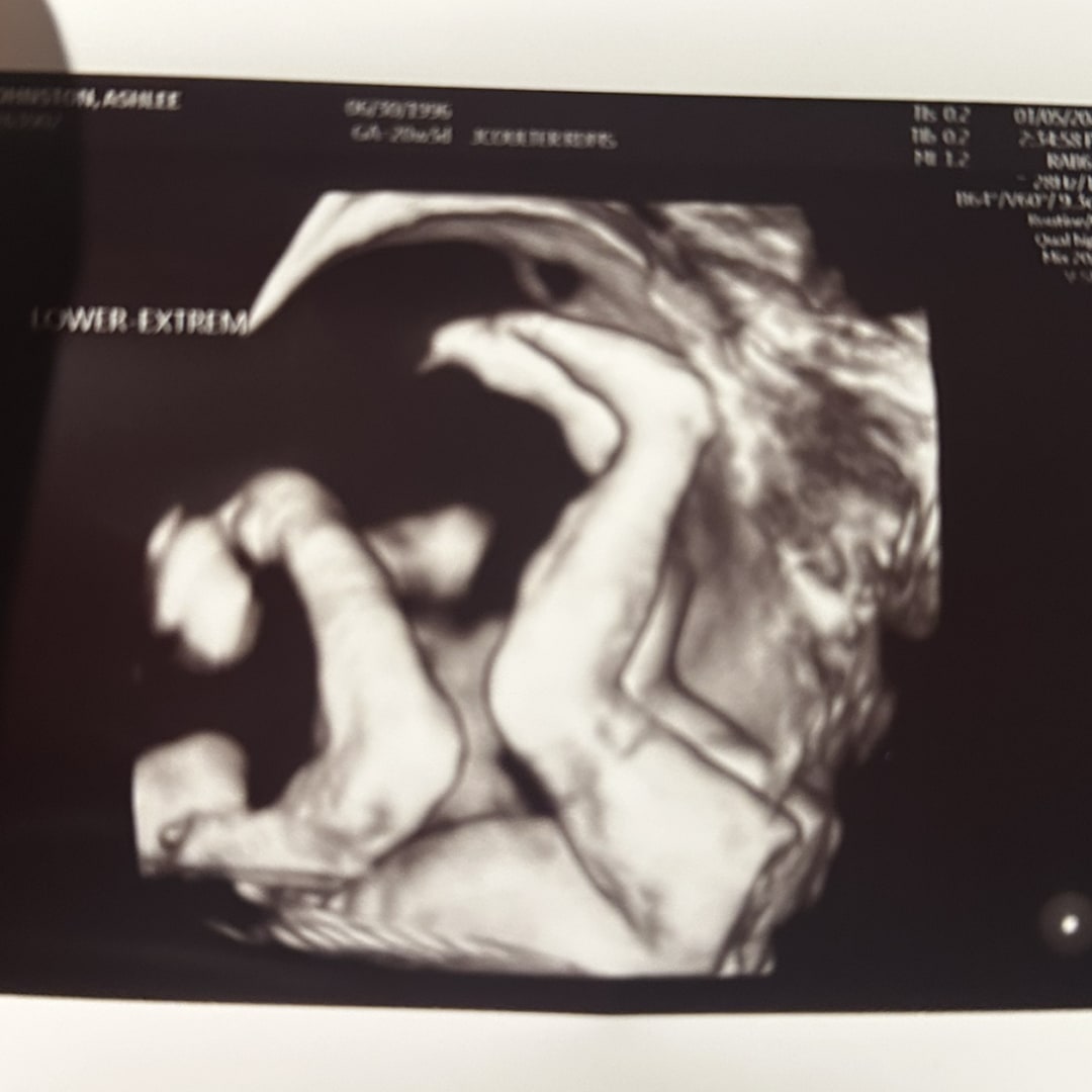 Photo shared by Ashlee for their Babylist baby registry.