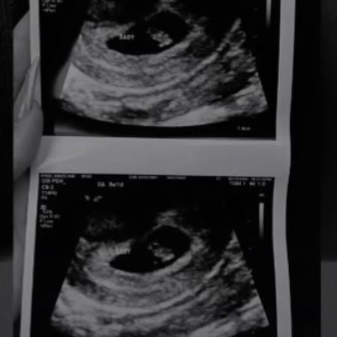 Photo shared by Gracelynn for their Babylist baby registry.