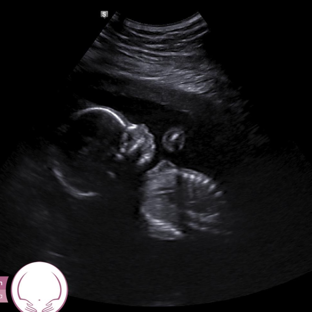 Photo shared by Maylie for their Babylist baby registry.