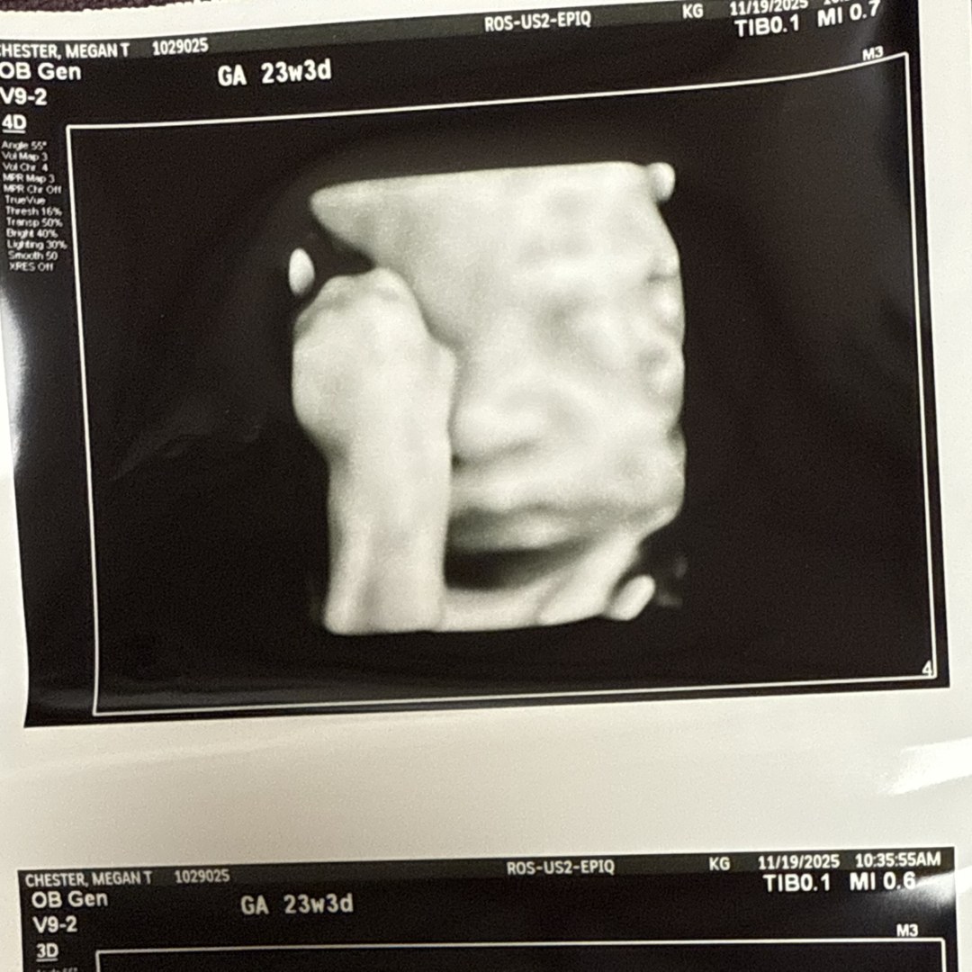 Photo shared by Megan for their Babylist baby registry.