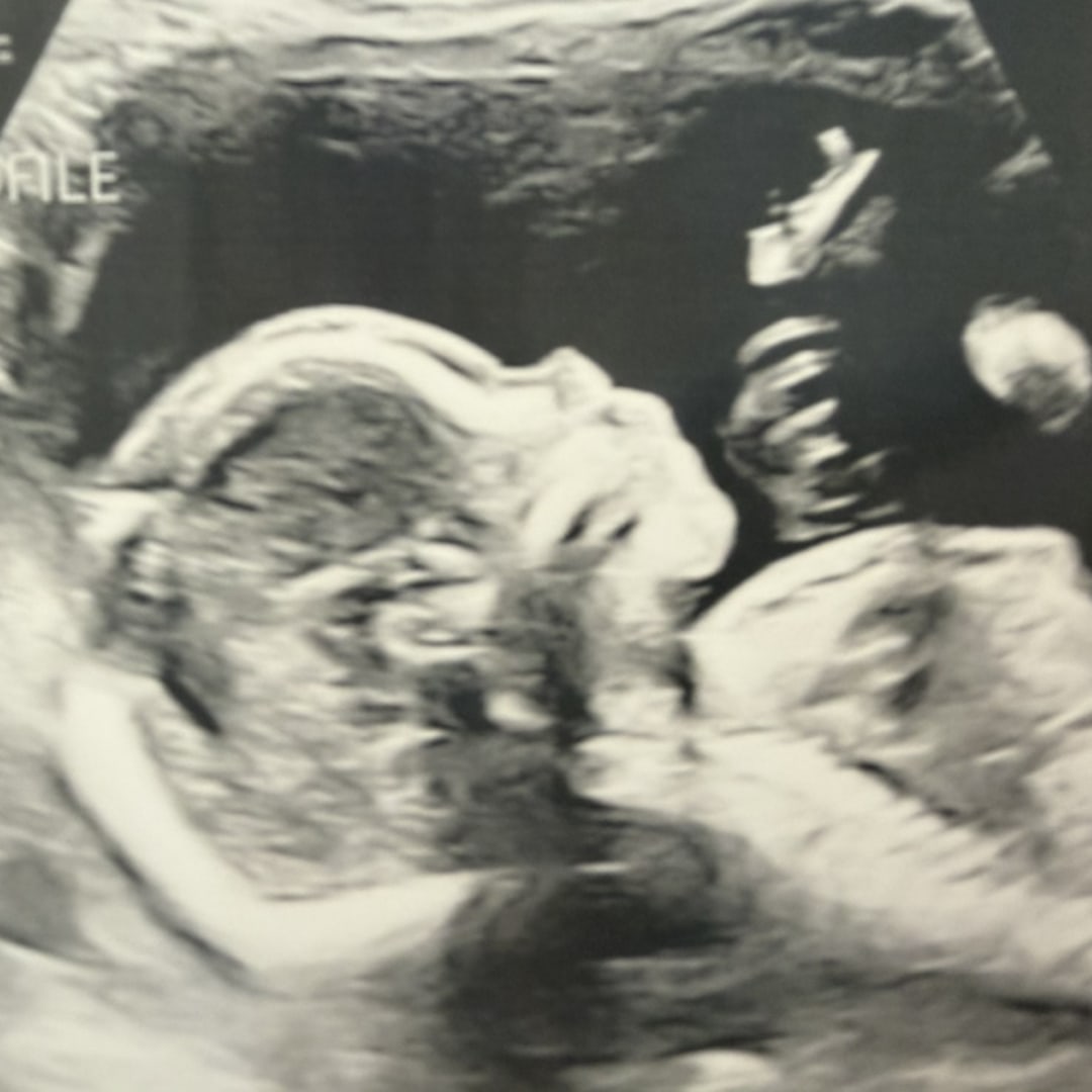 Photo shared by Hailey for their Babylist baby registry.