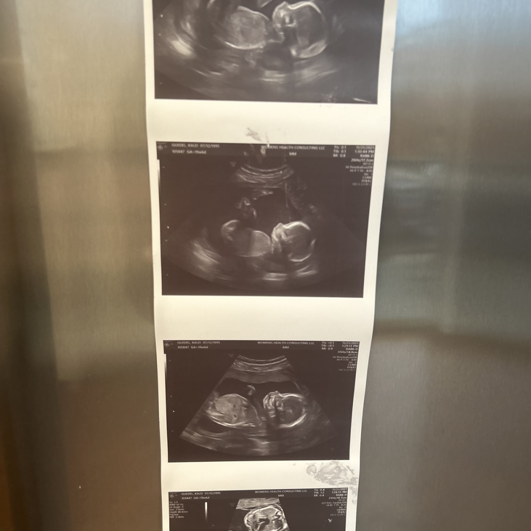 Photo shared by Kalei for their Babylist baby registry.