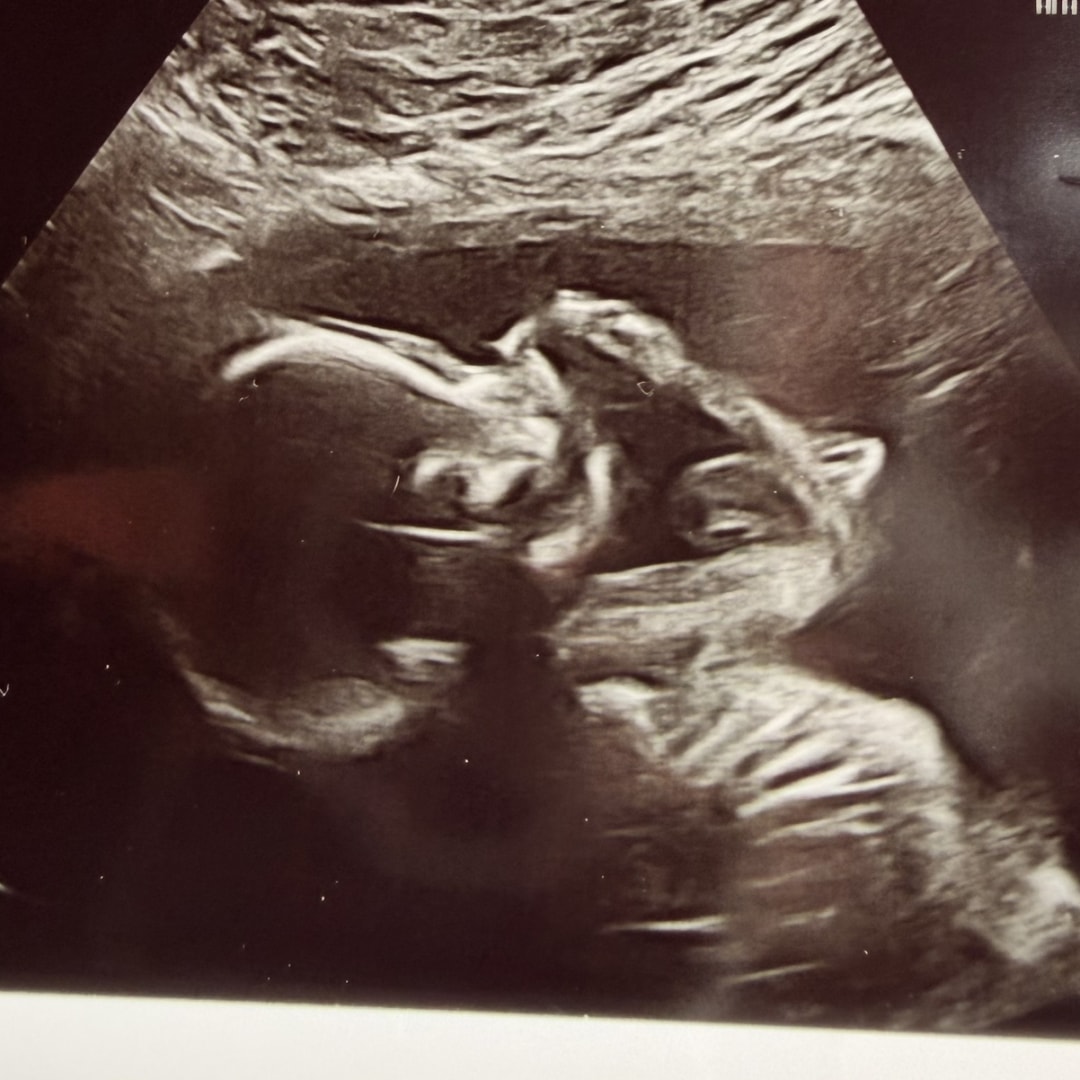Photo shared by Emily for their Babylist baby registry.