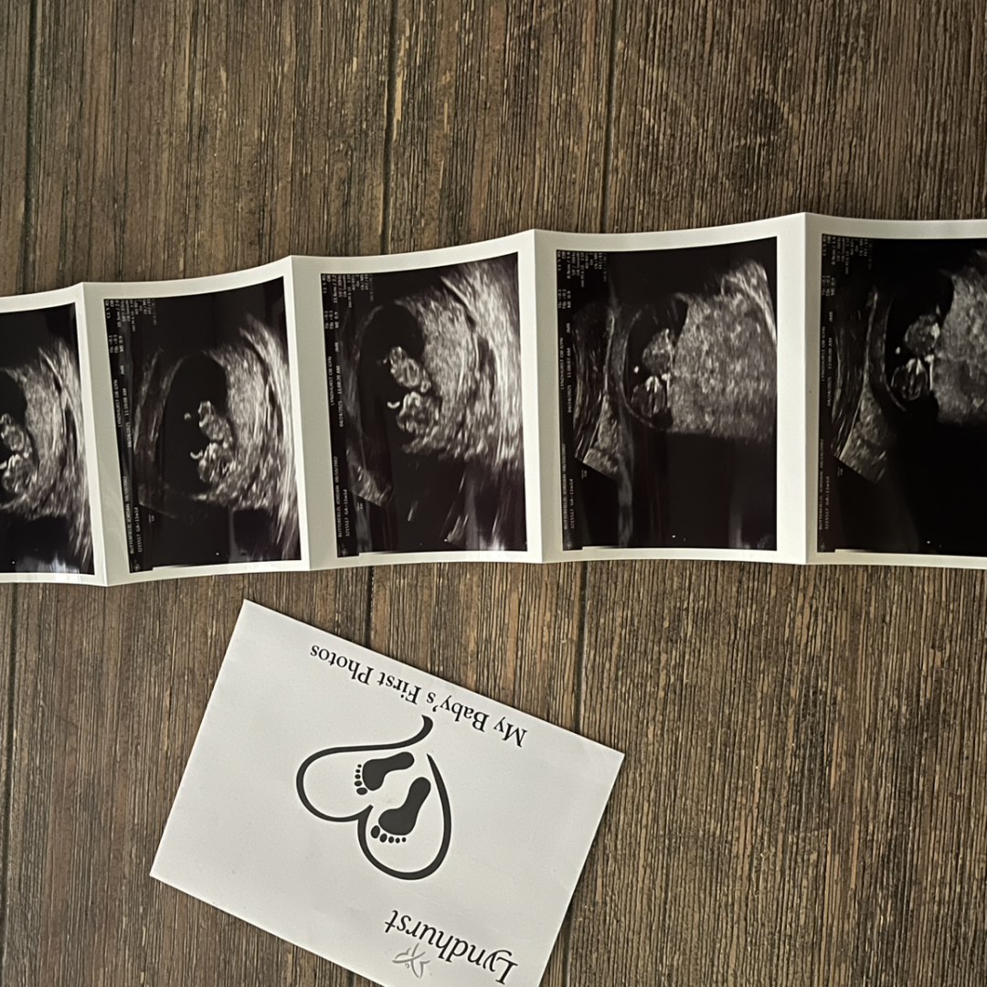 Photo shared by Jordan for their Babylist baby registry.