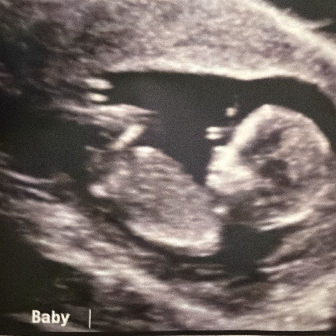 Photo shared by Niya for their Babylist baby registry.