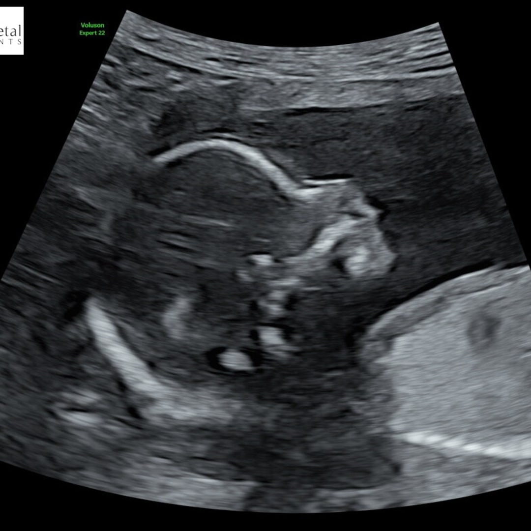 Photo shared by Annie for their Babylist baby registry.