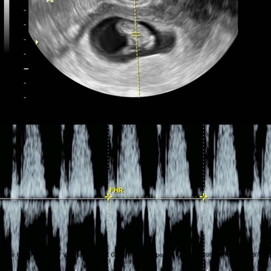 Photo shared by Amber for their Babylist baby registry.