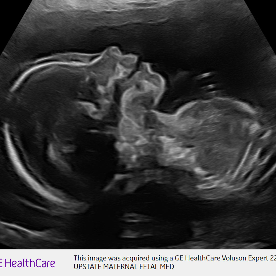 Photo shared by Stephanie for their Babylist baby registry.
