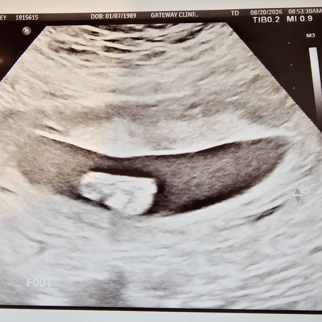 Photo shared by Ashley for their Babylist baby registry.