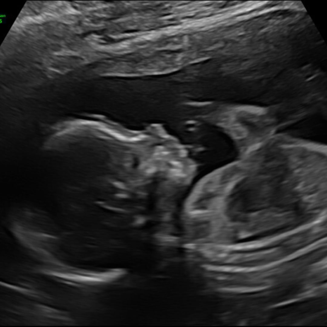 Photo shared by Jessica for their Babylist baby registry.