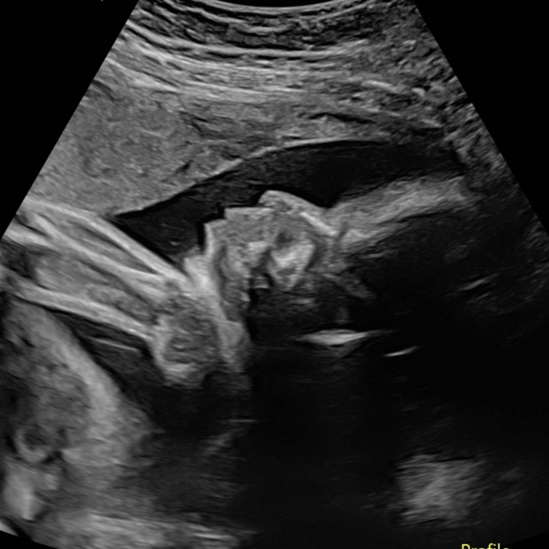 Photo shared by Natalie for their Babylist baby registry.