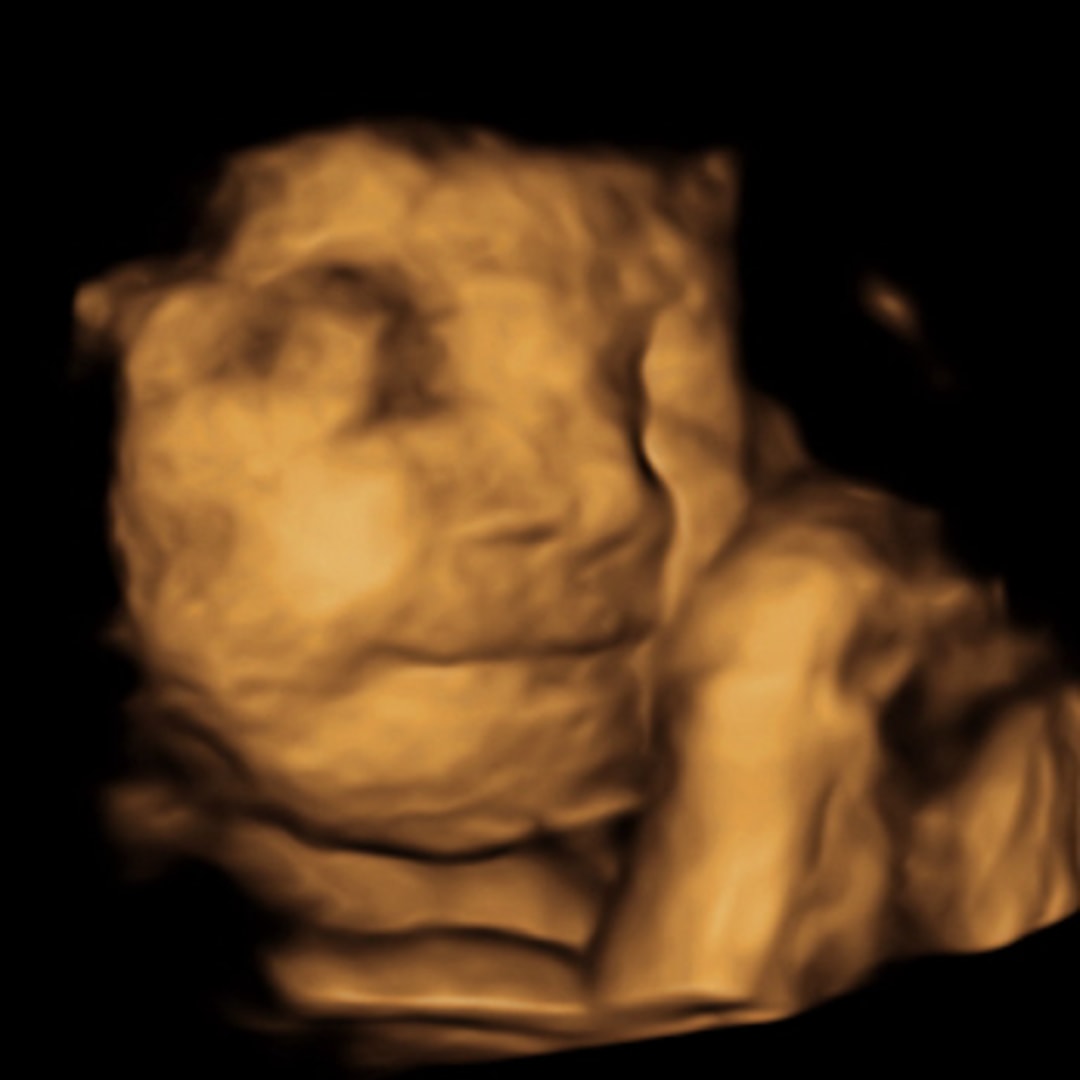 Photo shared by Stephanie for their Babylist baby registry.