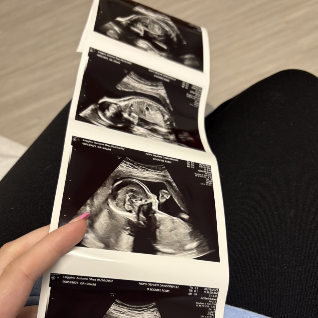 Photo shared by Autumn for their Babylist baby registry.