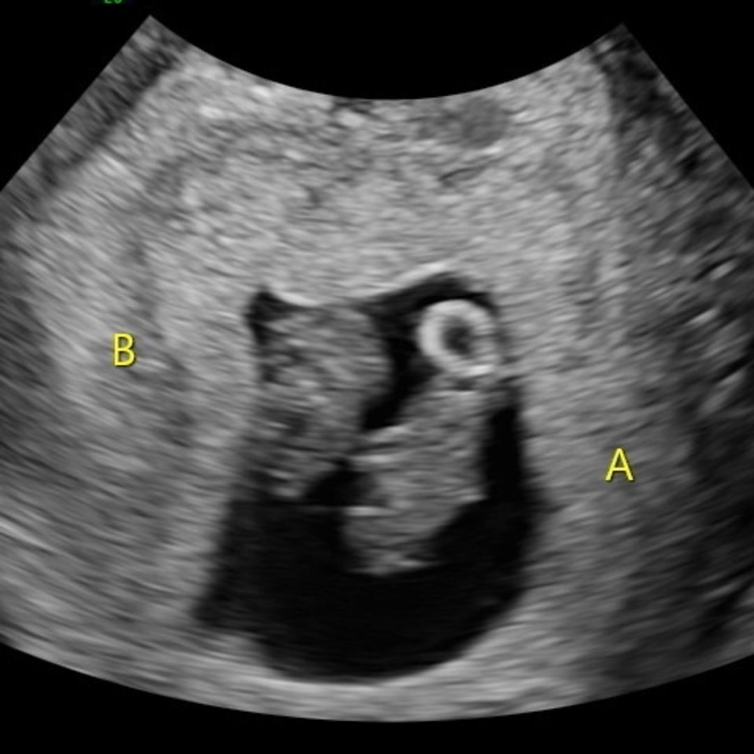 Photo shared by Bri for their Babylist baby registry.