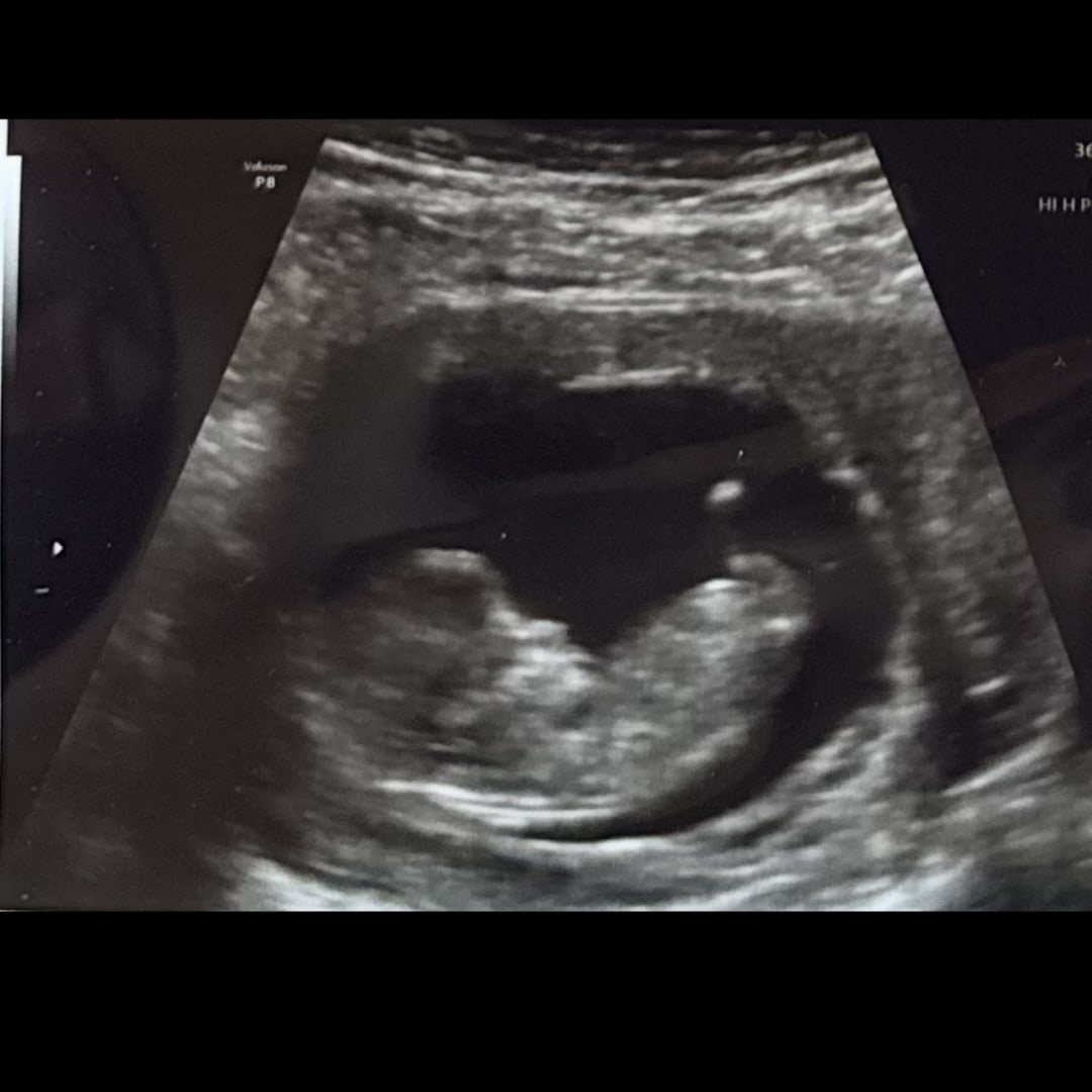 Photo shared by Hayley for their Babylist baby registry.