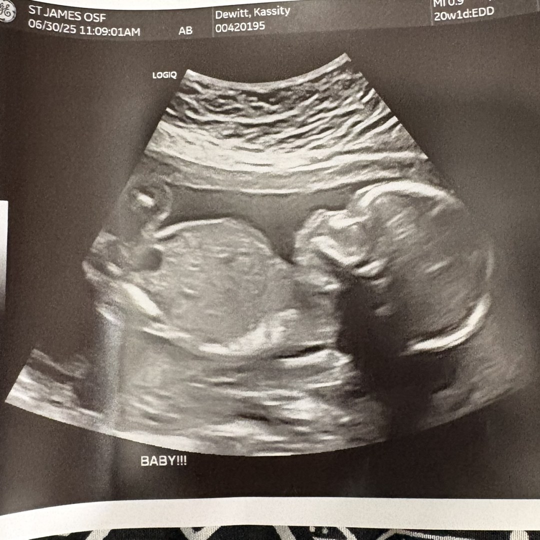 Photo shared by Kassity for their Babylist baby registry.