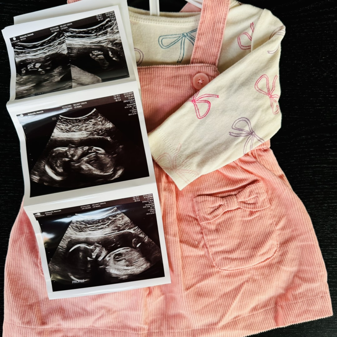 Photo shared by Hannah for their Babylist baby registry.
