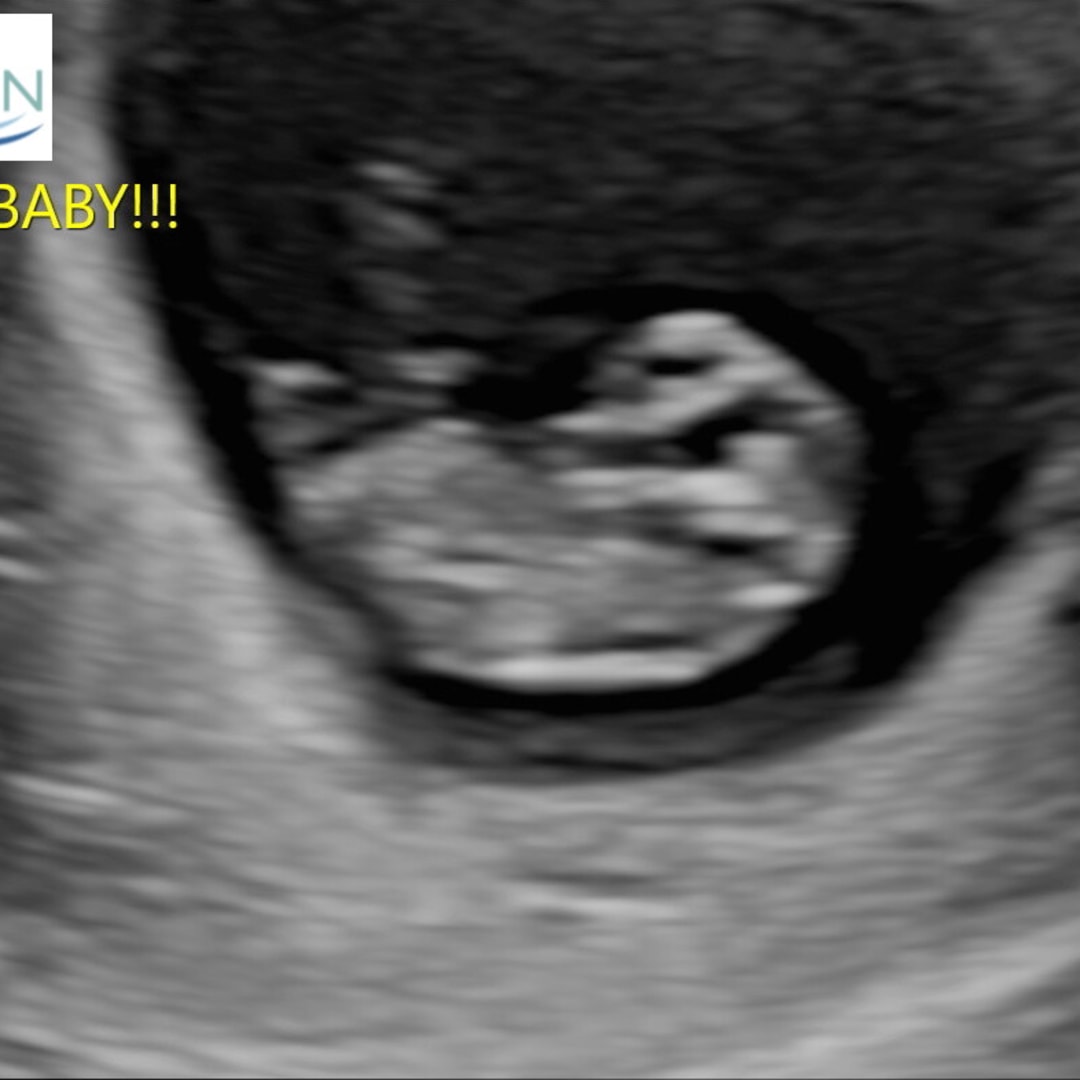Photo shared by Kora for their Babylist baby registry.