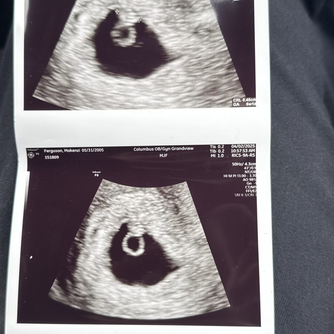 Photo shared by Kenzi for their Babylist baby registry.