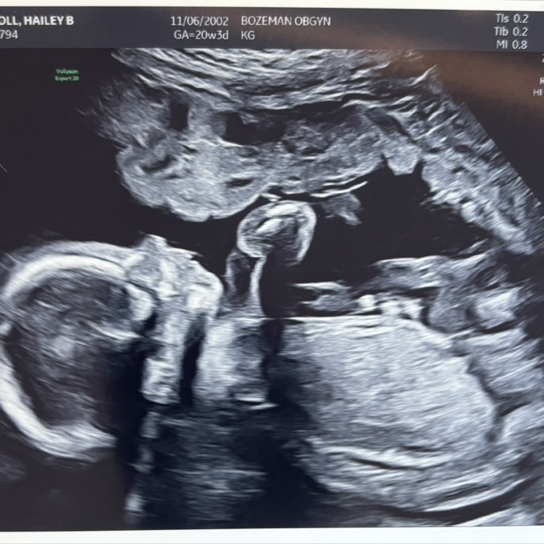 Photo shared by Hailey for their Babylist baby registry.