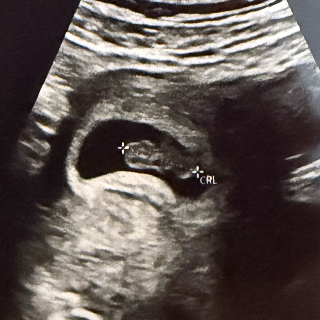 Photo shared by Renee for their Babylist baby registry.