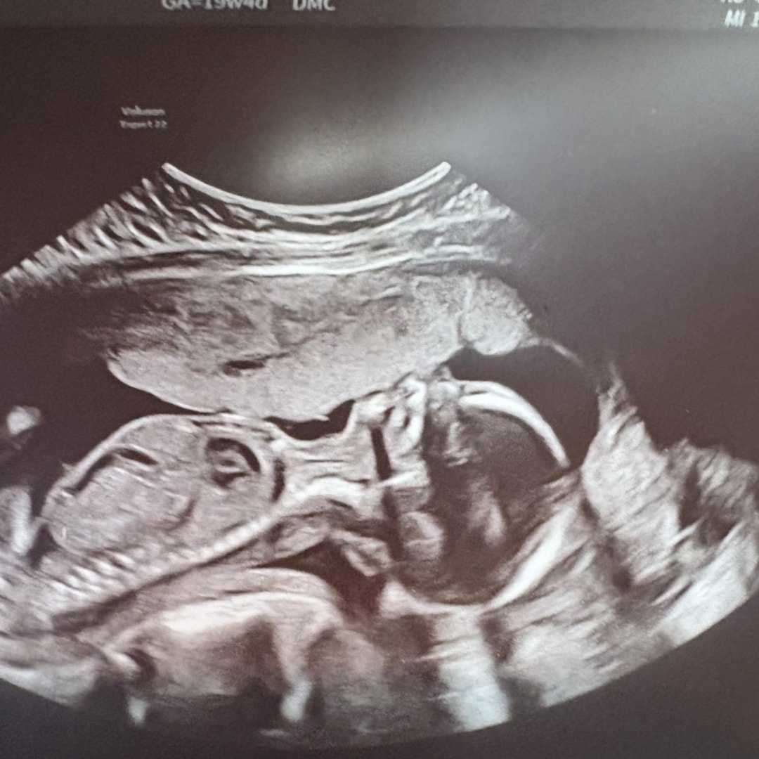 Photo shared by Hope for their Babylist baby registry.