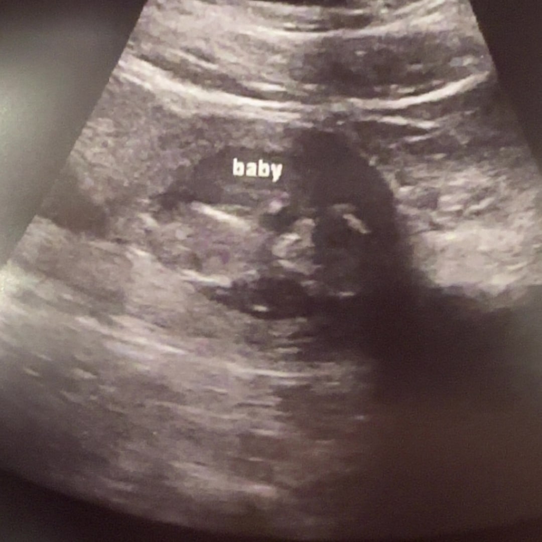 Photo shared by Marie for their Babylist baby registry.