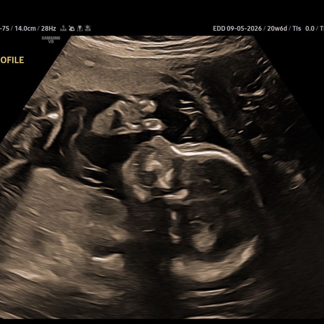 Photo shared by Izabella for their Babylist baby registry.