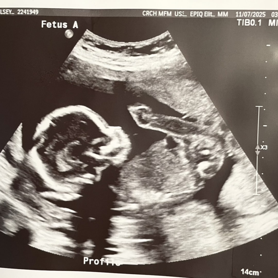 Photo shared by Chelsey for their Babylist baby registry.