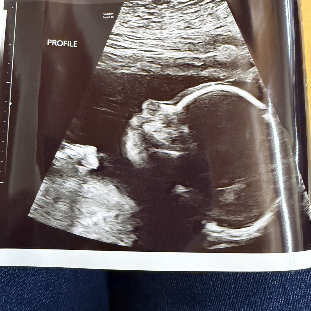 Photo shared by Danielle for their Babylist baby registry.